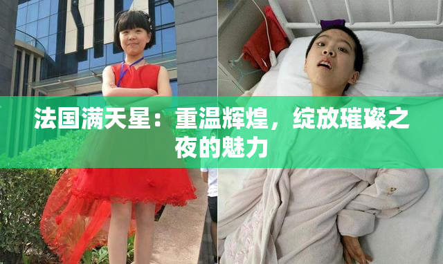 法国满天星：重温辉煌，绽放璀璨之夜的魅力