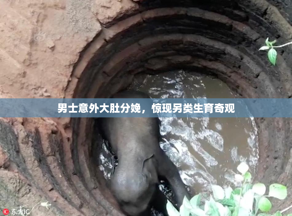 男士意外大肚分娩，惊现另类生育奇观