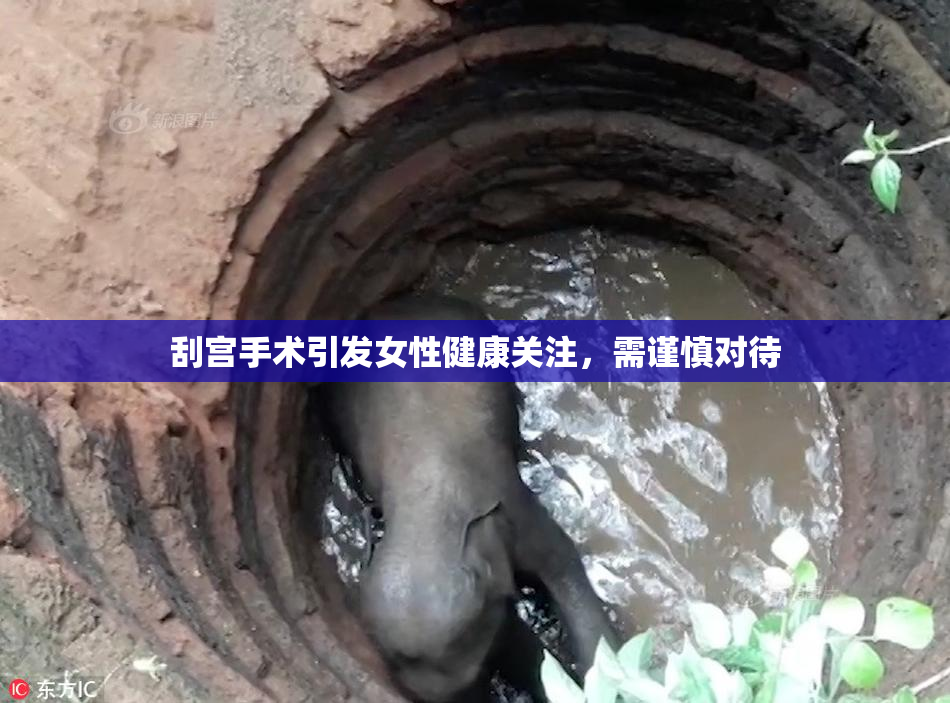 刮宫手术引发女性健康关注，需谨慎对待