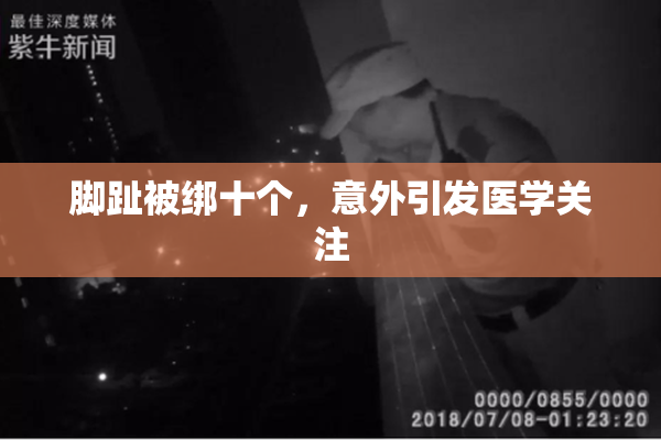 脚趾被绑十个，意外引发医学关注