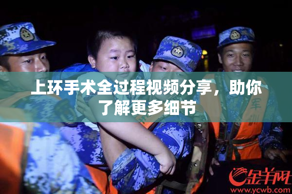 上环手术全过程视频分享，助你了解更多细节