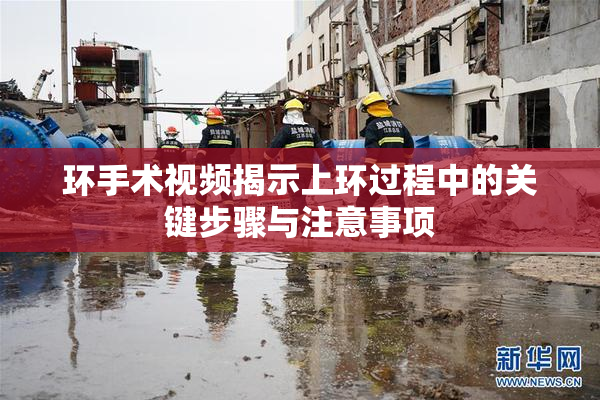 环手术视频揭示上环过程中的关键步骤与注意事项