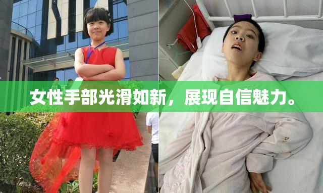 女性手部光滑如新，展现自信魅力。