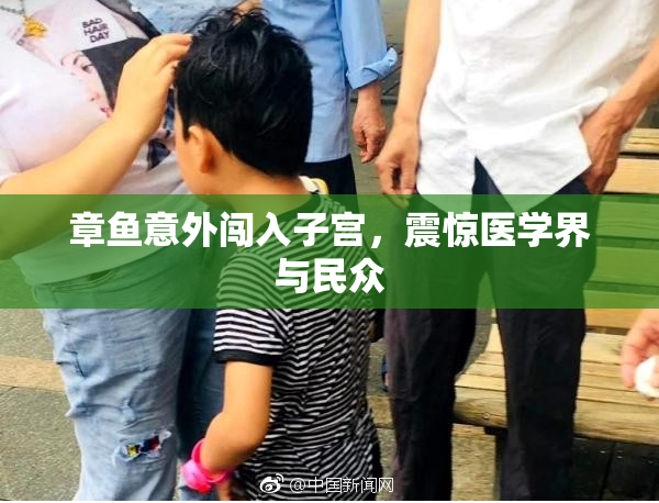 章鱼意外闯入子宫，震惊医学界与民众