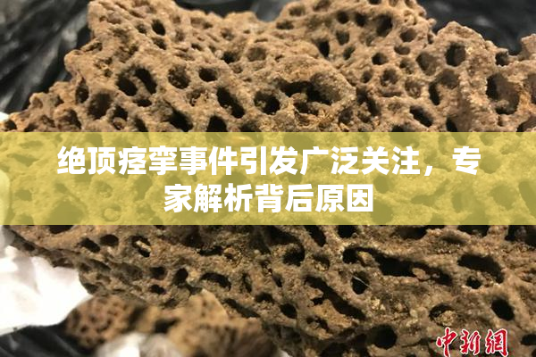 绝顶痉挛事件引发广泛关注，专家解析背后原因
