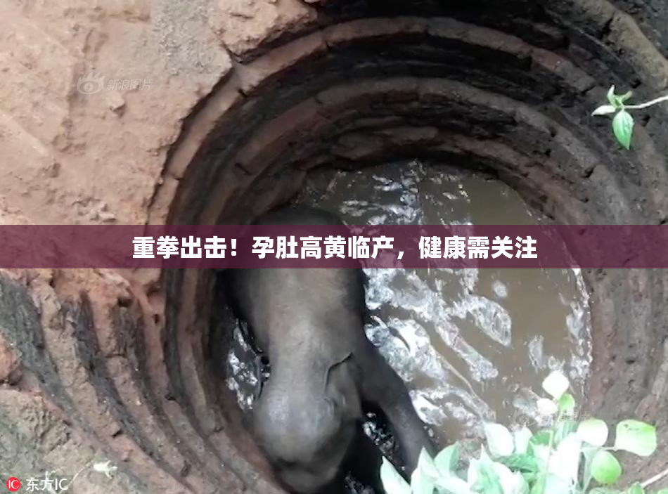 重拳出击！孕肚高黄临产，健康需关注