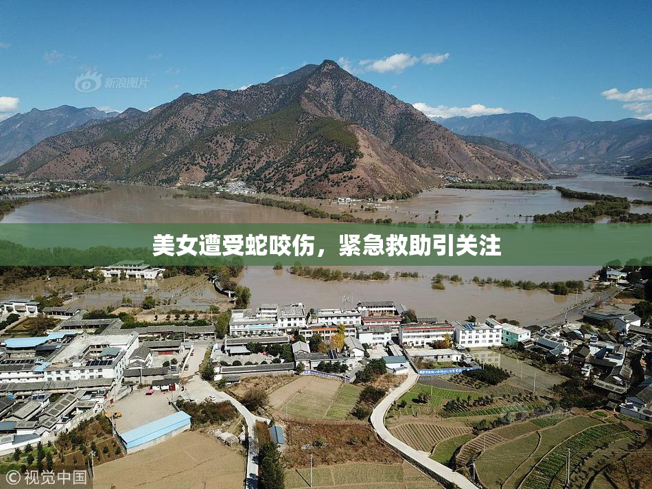 美女遭受蛇咬伤，紧急救助引关注