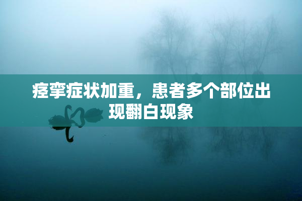 痉挛症状加重，患者多个部位出现翻白现象