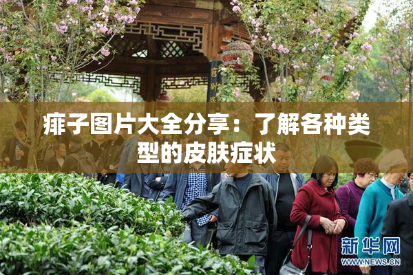 痱子图片大全分享：了解各种类型的皮肤症状